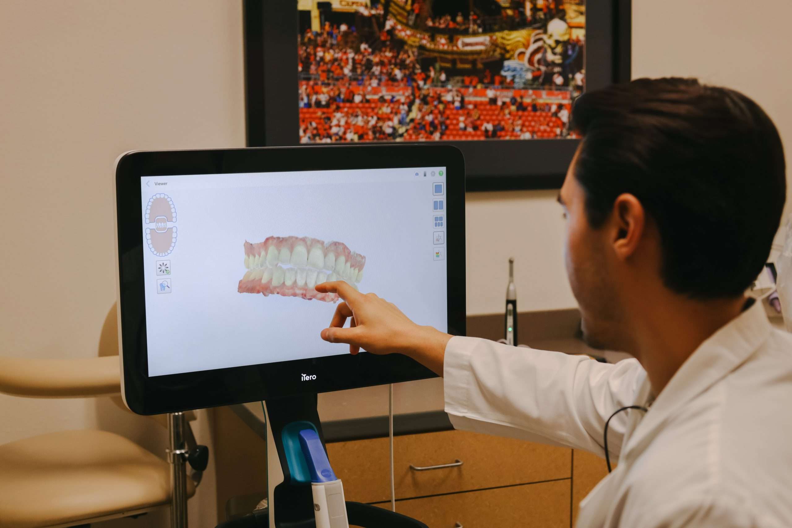 Friendly Smiles Dental Care Introduces the New iTero Scanner